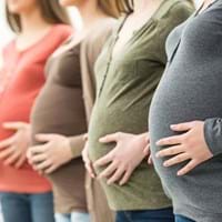 Vier schwangere Frauen